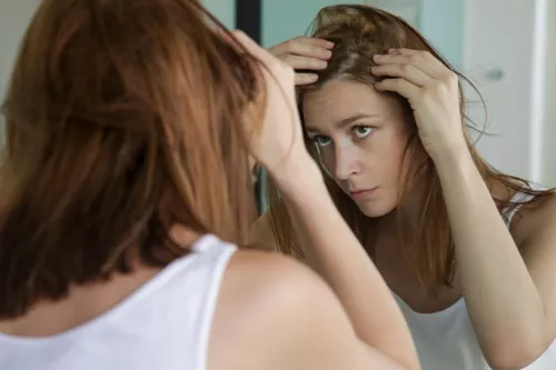 Alopécie : Qu’est-ce que c’est ? Comment traite-t-on la perte de cheveux rapide ?